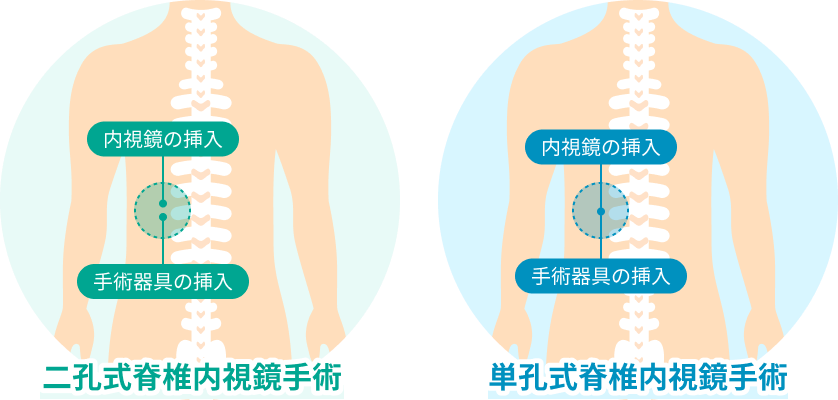 脊椎疾患の治療を中心に成長する韓国の神経外科- 韓国観光公社公式
